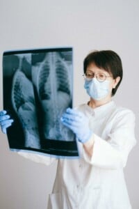 Læge studerer røntgenbillede af torso
